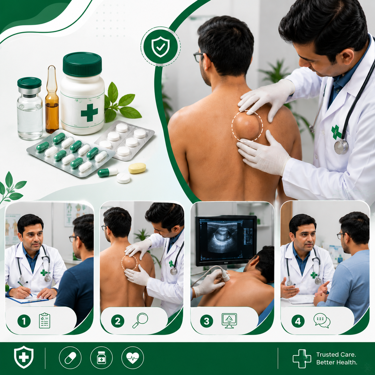 Lipoma Treatment